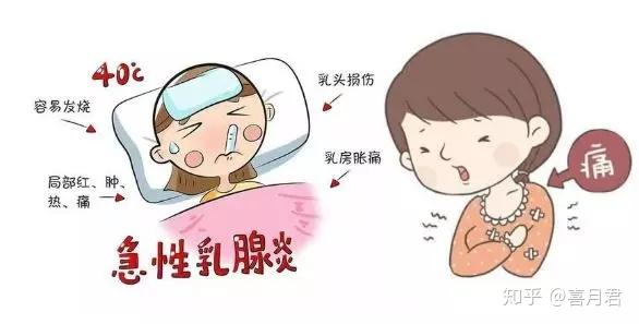乳腺炎反復(fù)發(fā)作？這6個方法很管用