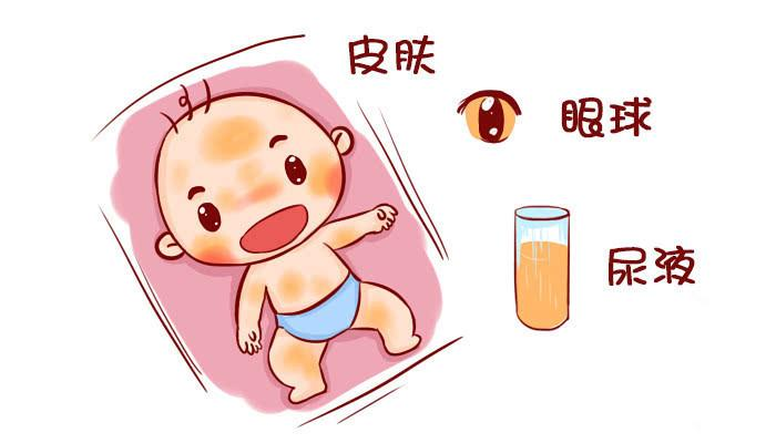 新生兒出生沒黃疸，大多是孕媽在孕期做了3件事